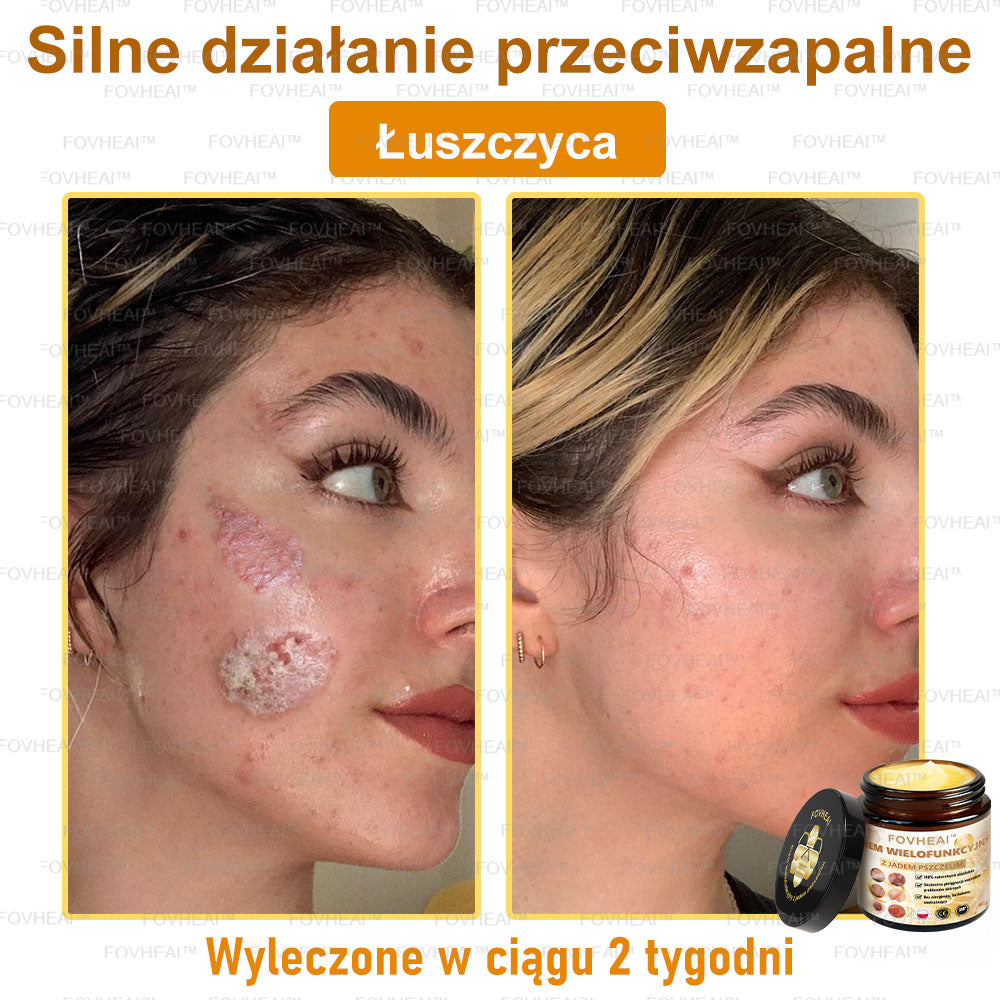 🏆 FOVHEAl™ Krem wielofunkcyjny z jadem pszczelim - Polecane przez dermatologów – Odpowiednie dla każdego wieku