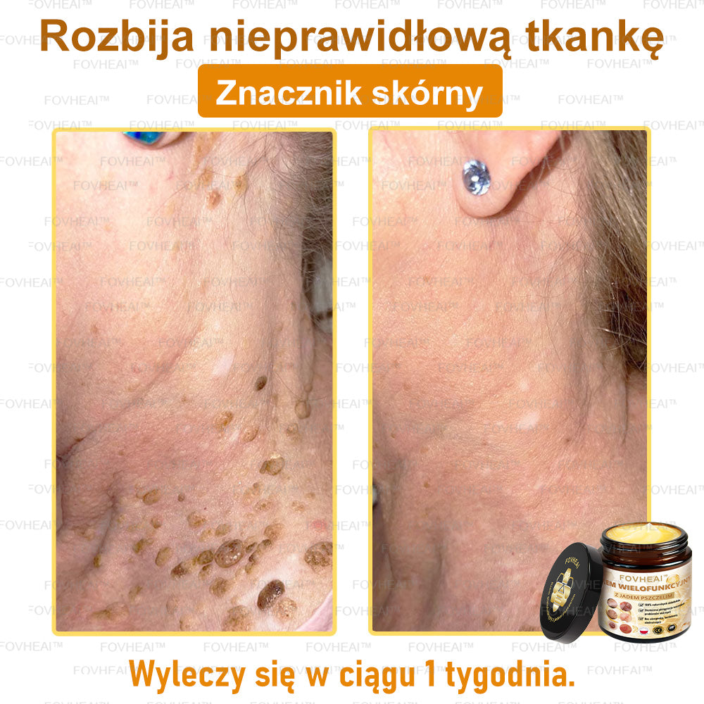 🏆 FOVHEAl™ Krem wielofunkcyjny z jadem pszczelim - Polecane przez dermatologów – Odpowiednie dla każdego wieku