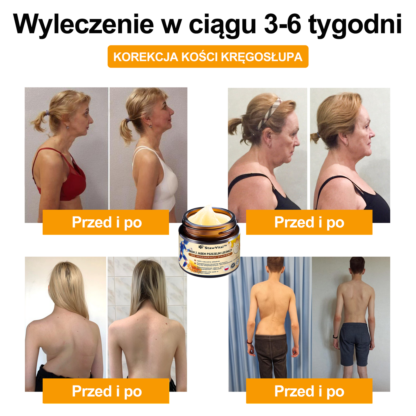 🎉🎉🎉Gratulacje! Jesteś w gronie pierwszych 200 zamówień! Skorzystaj z dodatkowego rabatu 50%! Działaj teraz, aby utrzymać zdrowie swoich stawów. Jeśli przegapisz tę okazję, będziesz musiał/a czekać do przyszłego roku!