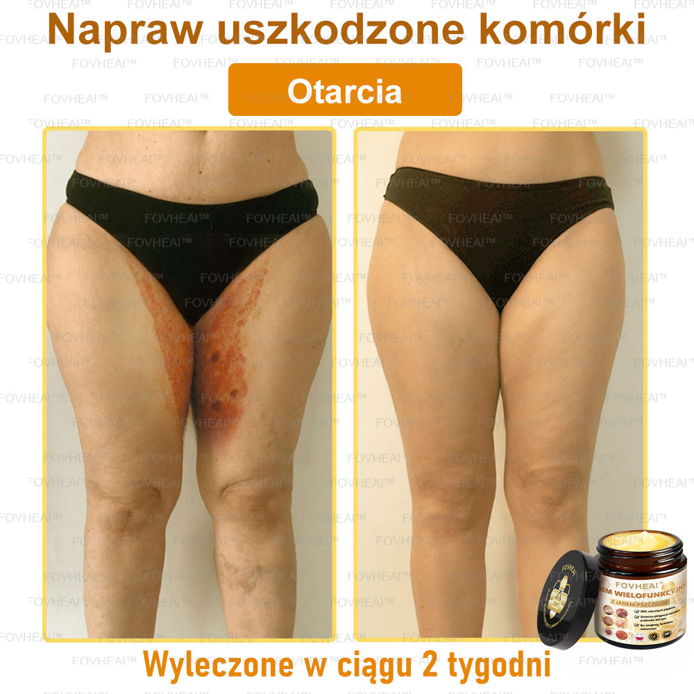 🏆 FOVHEAl™ Krem wielofunkcyjny z jadem pszczelim - Polecane przez dermatologów – Odpowiednie dla każdego wieku