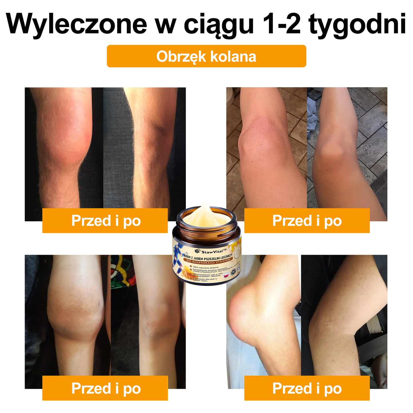 🎉🎉🎉Gratulacje! Jesteś w gronie pierwszych 200 zamówień! Skorzystaj z dodatkowego rabatu 50%! Działaj teraz, aby utrzymać zdrowie swoich stawów. Jeśli przegapisz tę okazję, będziesz musiał/a czekać do przyszłego roku!