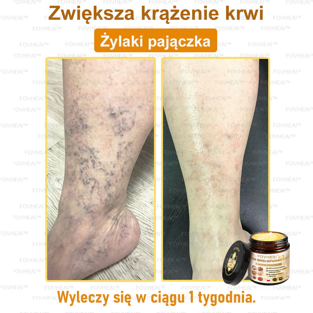 🏆 FOVHEAl™ Krem wielofunkcyjny z jadem pszczelim - Polecane przez dermatologów – Odpowiednie dla każdego wieku