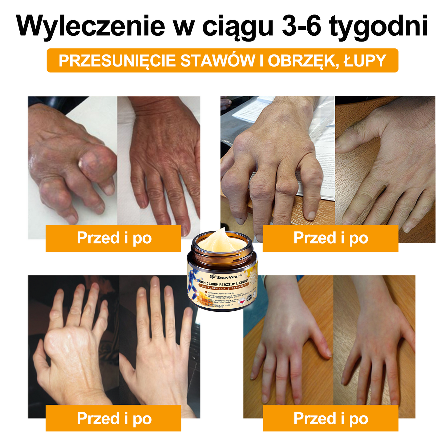 🎉🎉🎉Gratulacje! Jesteś w gronie pierwszych 200 zamówień! Skorzystaj z dodatkowego rabatu 50%! Działaj teraz, aby utrzymać zdrowie swoich stawów. Jeśli przegapisz tę okazję, będziesz musiał/a czekać do przyszłego roku!
