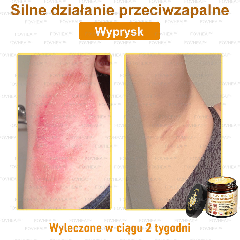 🏆 FOVHEAl™ Krem wielofunkcyjny z jadem pszczelim - Polecane przez dermatologów – Odpowiednie dla każdego wieku