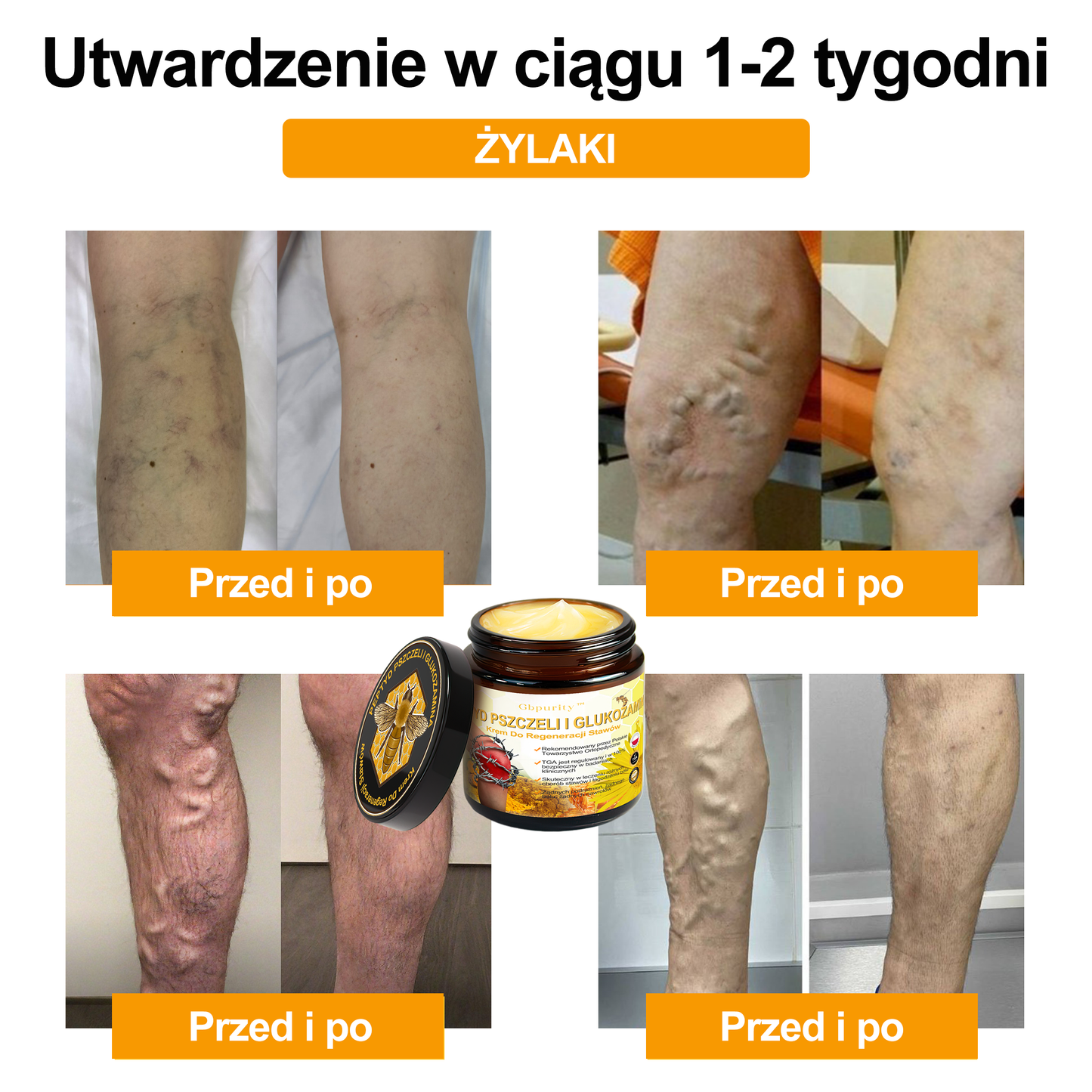 🛡️Gbpurity™ Krem Do Regeneracji Stawów | Dla osób w średnim i późnym wieku