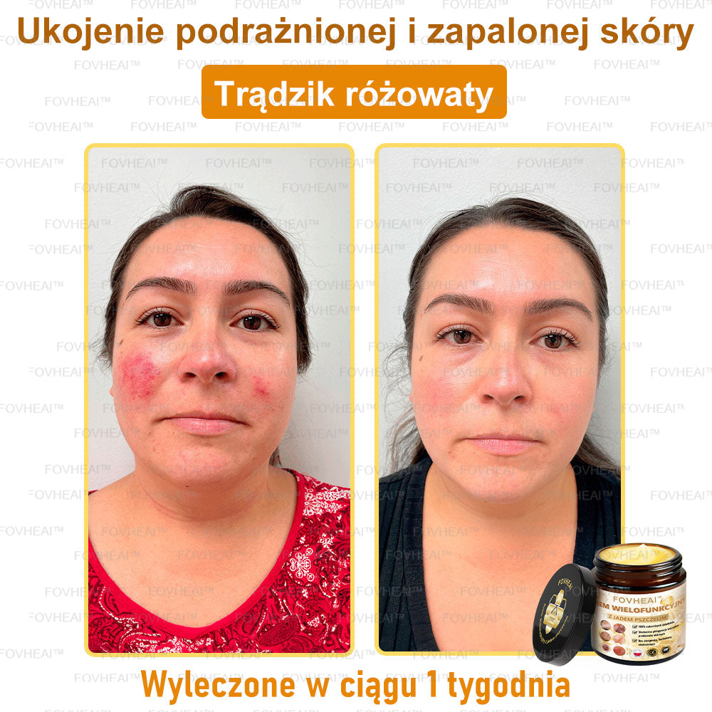 🏆 FOVHEAl™ Krem wielofunkcyjny z jadem pszczelim - Polecane przez dermatologów – Odpowiednie dla każdego wieku