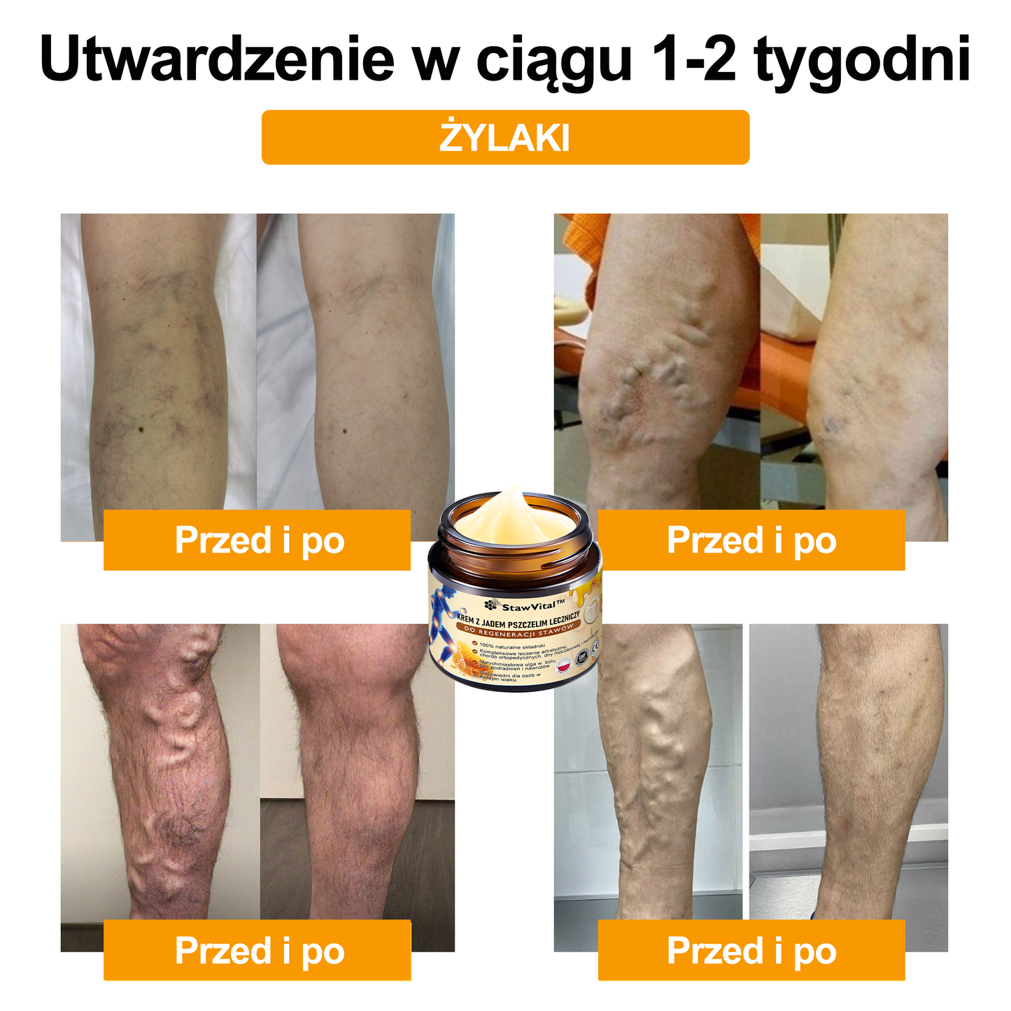 🎉🎉🎉Gratulacje! Jesteś w gronie pierwszych 200 zamówień! Skorzystaj z dodatkowego rabatu 50%! Działaj teraz, aby utrzymać zdrowie swoich stawów. Jeśli przegapisz tę okazję, będziesz musiał/a czekać do przyszłego roku!