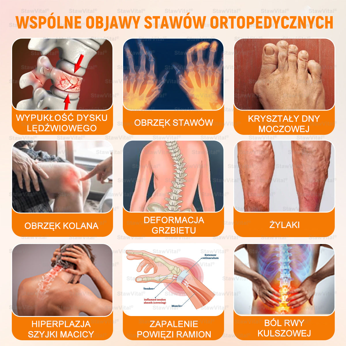 🎉🎉🎉Gratulacje! Jesteś w gronie pierwszych 200 zamówień! Skorzystaj z dodatkowego rabatu 50%! Działaj teraz, aby utrzymać zdrowie swoich stawów. Jeśli przegapisz tę okazję, będziesz musiał/a czekać do przyszłego roku!