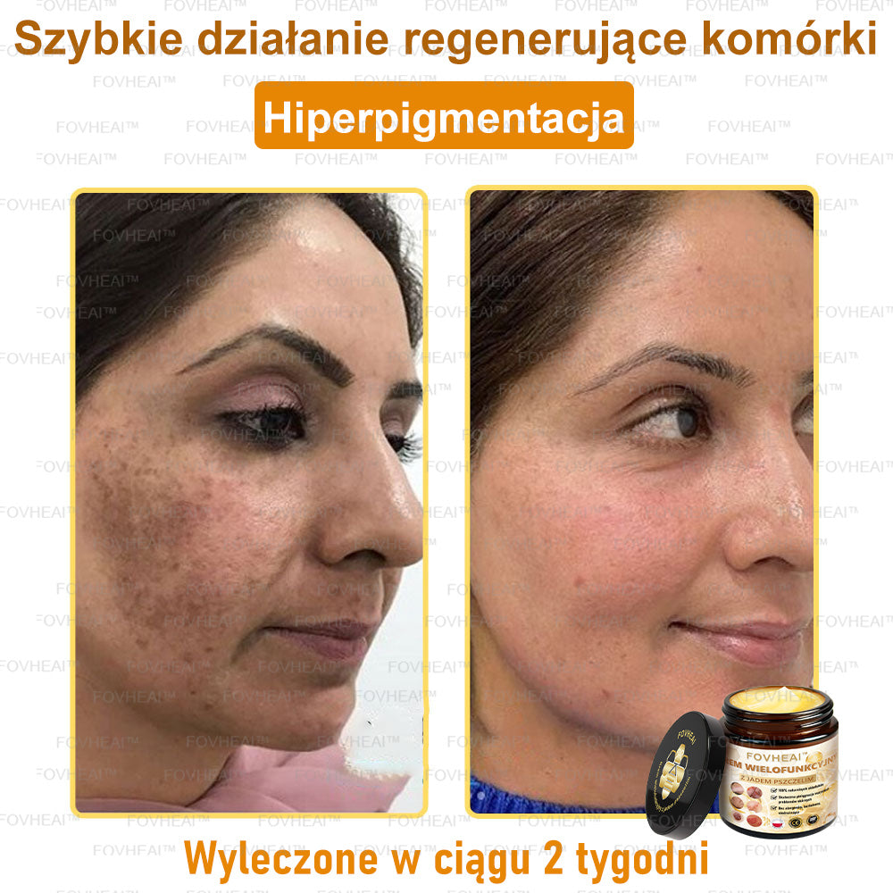 🏆 FOVHEAl™ Krem wielofunkcyjny z jadem pszczelim - Polecane przez dermatologów – Odpowiednie dla każdego wieku