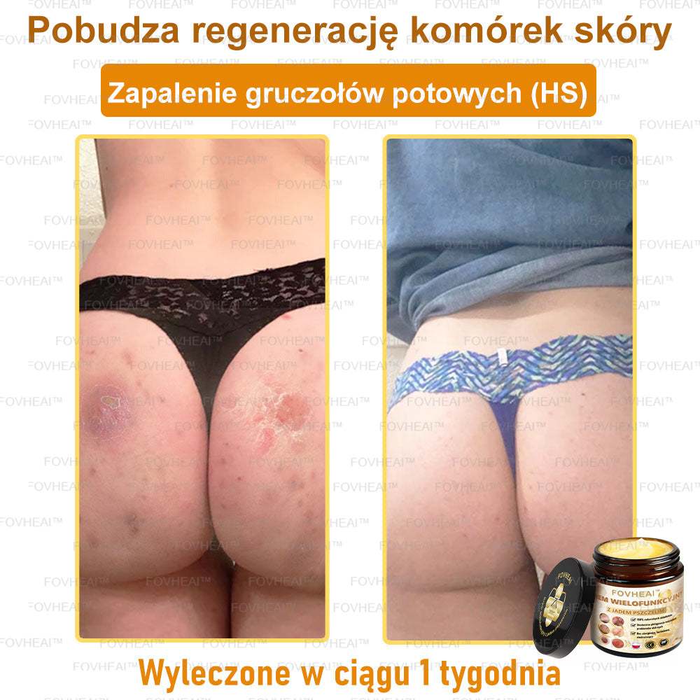 🏆 FOVHEAl™ Krem wielofunkcyjny z jadem pszczelim - Polecane przez dermatologów – Odpowiednie dla każdego wieku