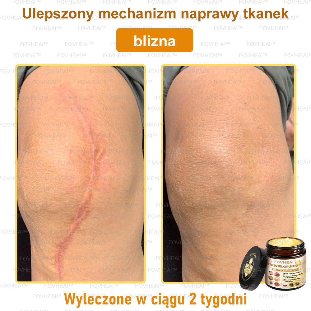 🏆 FOVHEAl™ Krem wielofunkcyjny z jadem pszczelim - Polecane przez dermatologów – Odpowiednie dla każdego wieku