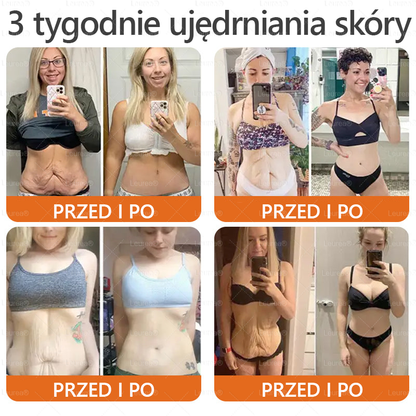 ✨Leurea® Krem Regenerujący z Jadem Pszczelim🔥 Naturalna regeneracja skóry, wygładzenie zmarszczek i promienna cera-50 ml🔥🔥