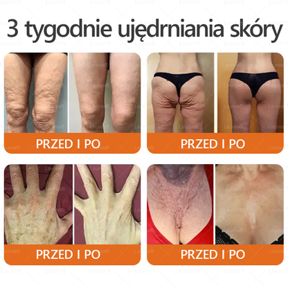 ✨Leurea® Krem Regenerujący z Jadem Pszczelim🔥 Naturalna regeneracja skóry, wygładzenie zmarszczek i promienna cera-50 ml🔥🔥