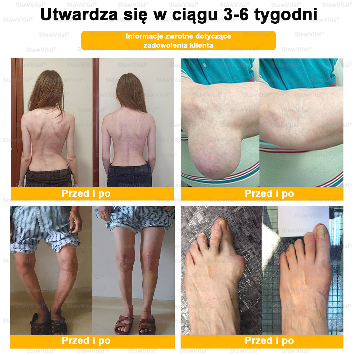 🔱 𝑺𝒕𝒂𝒘𝑽𝒊𝒕𝒂𝒍® 𝑲𝒓𝒆𝒎 𝒛 𝑱𝒂𝒅𝒆𝒎 𝑷𝒔𝒛𝒄𝒛𝒆𝒍𝒊𝒎 𝑳𝒆𝒄𝒛𝒏𝒊𝒄𝒛𝒚 𝒅𝒐 𝑹𝒆𝒈𝒆𝒏𝒆𝒓𝒂𝒄𝒋𝒊 𝑺𝒕𝒂𝒘ó𝒘 🏃‍♀️ (𝒆𝒌𝒔𝒕𝒓𝒂𝒌𝒕 𝒛 𝒑𝒔𝒛𝒄𝒛𝒐ł𝒚 𝒏𝒐𝒘𝒐𝒛𝒆𝒍𝒂𝒏𝒅𝒛𝒌𝒊𝒆𝒋 - 𝒘𝒚𝒔𝒑𝒆𝒄𝒋𝒂𝒍𝒊𝒛𝒐𝒘𝒂𝒏𝒚 𝒘 𝒍𝒆𝒄𝒛𝒆𝒏𝒊𝒖 𝒔𝒄𝒉𝒐𝒓𝒛𝒆ń 𝒐𝒓𝒕𝒐𝒑𝒆𝒅𝒚𝒄𝒛𝒏𝒚𝒄𝒉 𝒊 𝒃ó𝒍𝒖 𝒔𝒕𝒂𝒘ó𝒘)