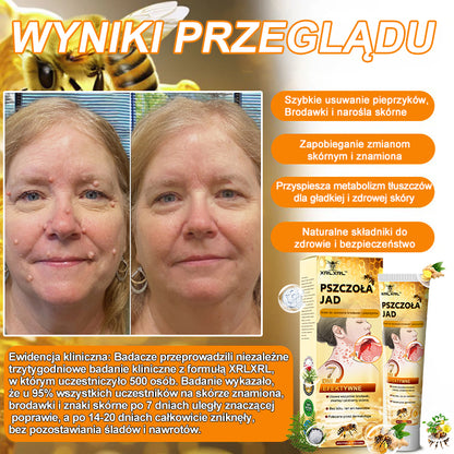 🌿🌿🌿[✨Oficjalny sklep markowy✨] krem XRLXRL™ PSZCZOŁA JAD do usuwania brodawek i pieprzyków(👨‍⚕️PTD AJÁNLJA)