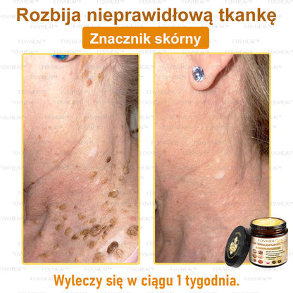 ✨FOVHEAl™ Krem wielofunkcyjny z jadem pszczelim - Polecane przez dermatologów – Odpowiednie dla każdego wieku-50 ml