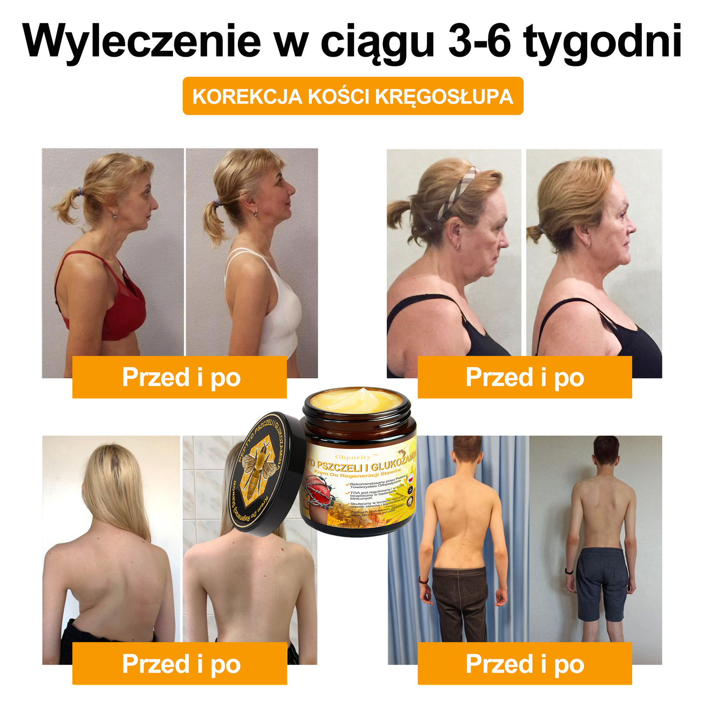 🛡️Gbpurity™ Krem Do Regeneracji Stawów | Dla osób w średnim i późnym wieku