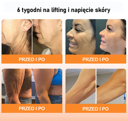 🏆【Oficjalny Sklep Markowy】SkóraViva™ Zaawansowane Serum Przeciwzmarszczkowy Ujędrniający （⭐Usuwanie zmarszczek i zwiotczenia⭐Przywracanie elastyczności skóry⭐）