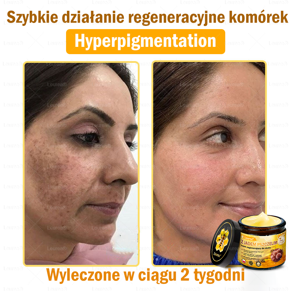 ✨Leurea® Krem Regenerujący z Jadem Pszczelim🔥 Naturalna regeneracja skóry, wygładzenie zmarszczek i promienna cera-50 ml🔥🔥