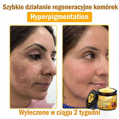 ✨Leurea® Krem Regenerujący z Jadem Pszczelim🔥 Naturalna regeneracja skóry, wygładzenie zmarszczek i promienna cera-50 ml🔥🔥