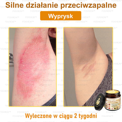 ✨FOVHEAl™ Krem wielofunkcyjny z jadem pszczelim - Polecane przez dermatologów – Odpowiednie dla każdego wieku-50 ml