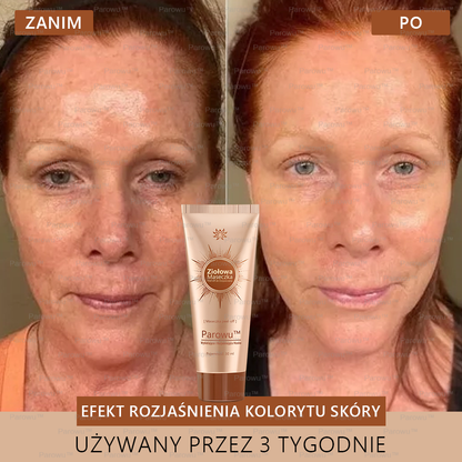 Parowu™ Wybielająca i Rozjaśniająca Maska ✅- Naturalne składniki trwale usuwają plamy, piegi i przebarwienia🔥🔥