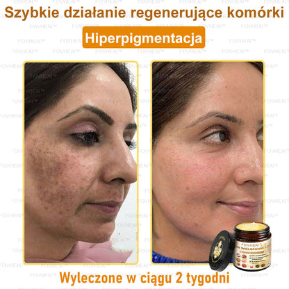 ✨FOVHEAl™ Krem wielofunkcyjny z jadem pszczelim - Polecane przez dermatologów – Odpowiednie dla każdego wieku-50 ml