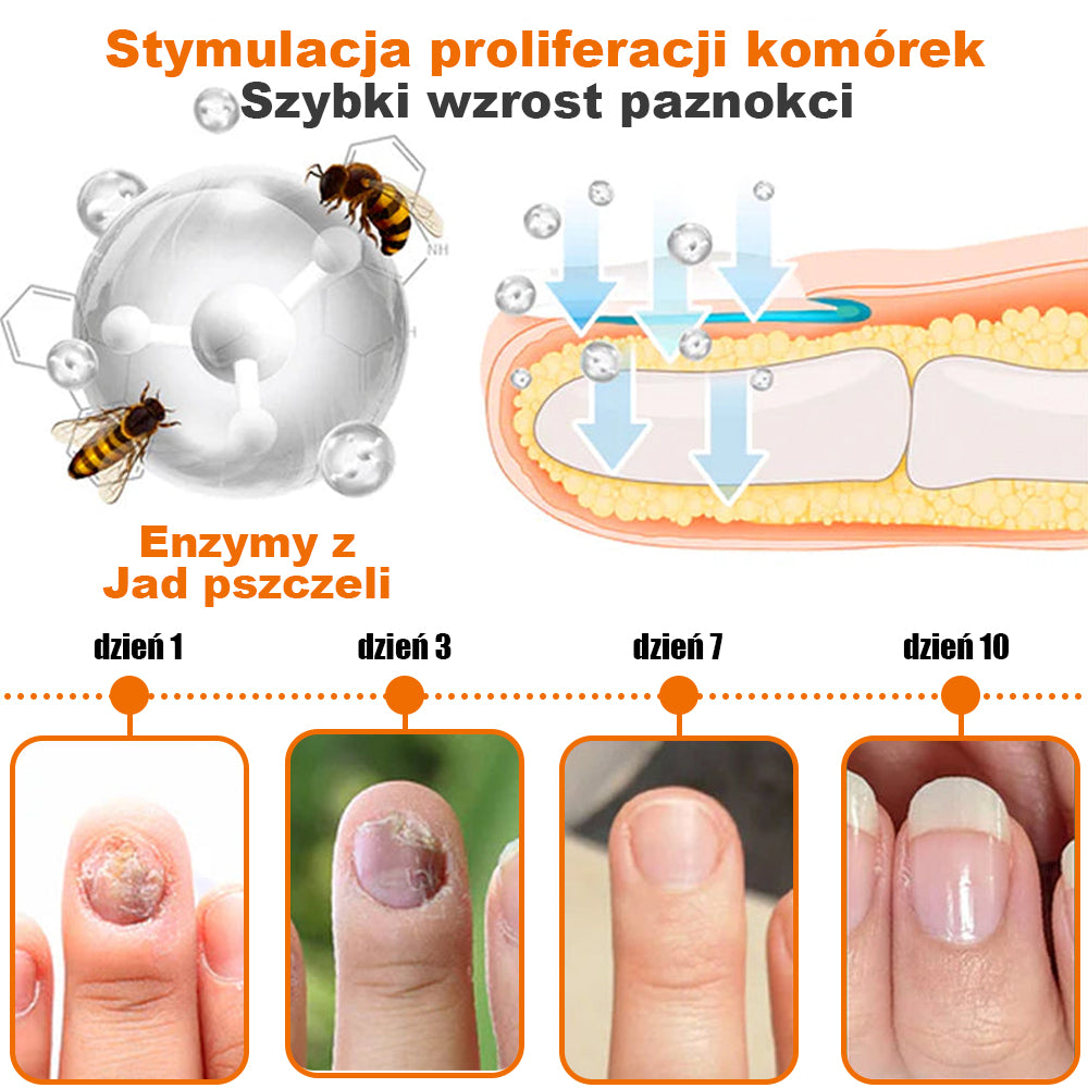 [✨Oficjalny sklep markowy✨]PaznokciVital™ Serum do paznokci FungiFree z jadem pszczelim