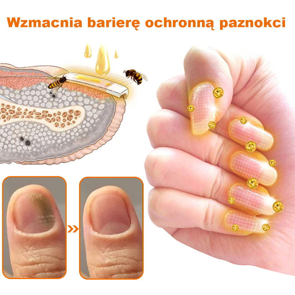 [✨Oficjalny sklep markowy✨]PaznokciVital™ Serum do paznokci FungiFree z jadem pszczelim