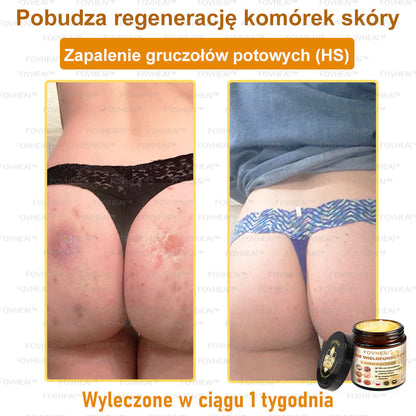 ✨FOVHEAl™ Krem wielofunkcyjny z jadem pszczelim - Polecane przez dermatologów – Odpowiednie dla każdego wieku-50 ml