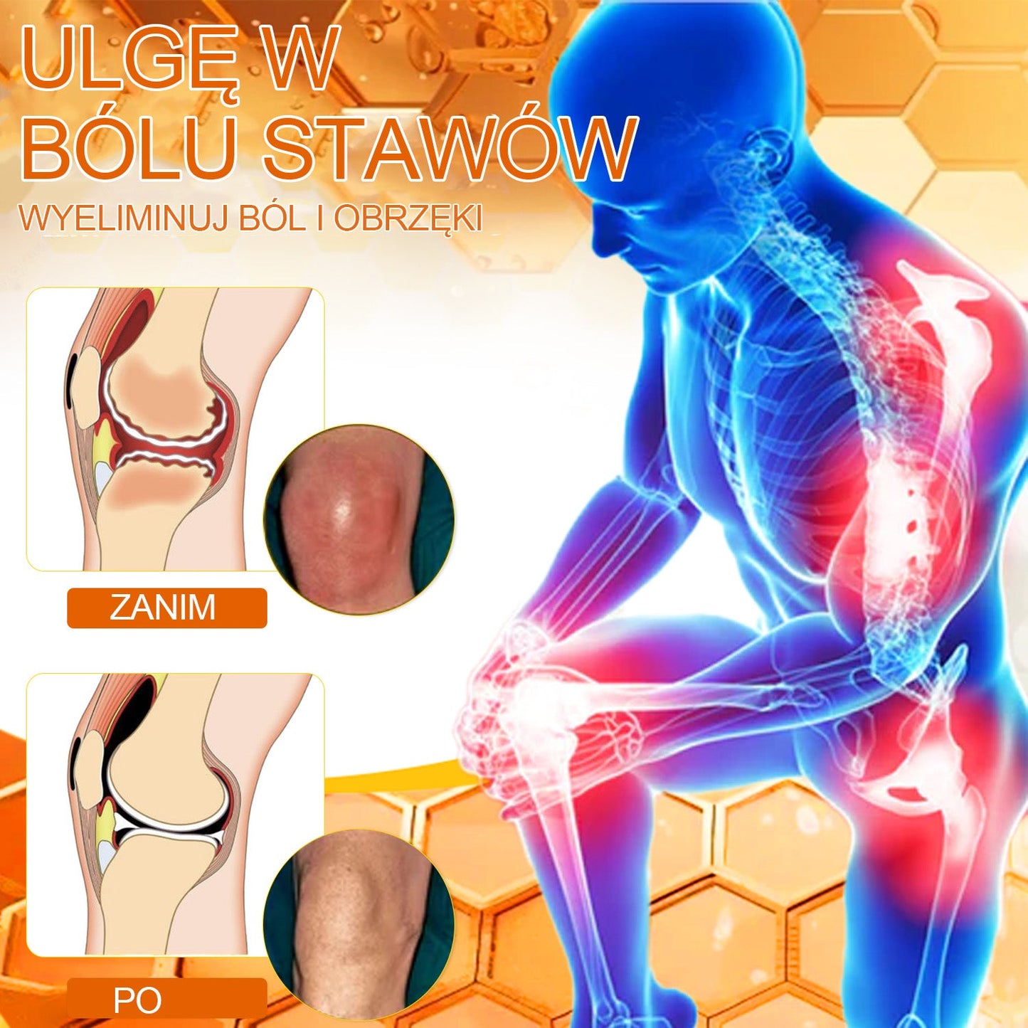 🔥𝑺𝒕𝒂𝒘𝑽𝒊𝒕𝒂𝒍™ Krem z Jadem Pszczelim Leczniczy do Regeneracji Stawów - Zalecane przez Polskie Towarzystwo Ortopedyczne i Traumatologiczne🐝🐝